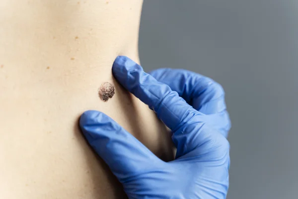Medical Dermatology