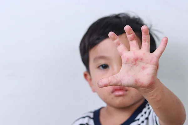 Pediatric Dermatology